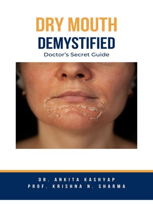 cover image of Dry mouth Demystified